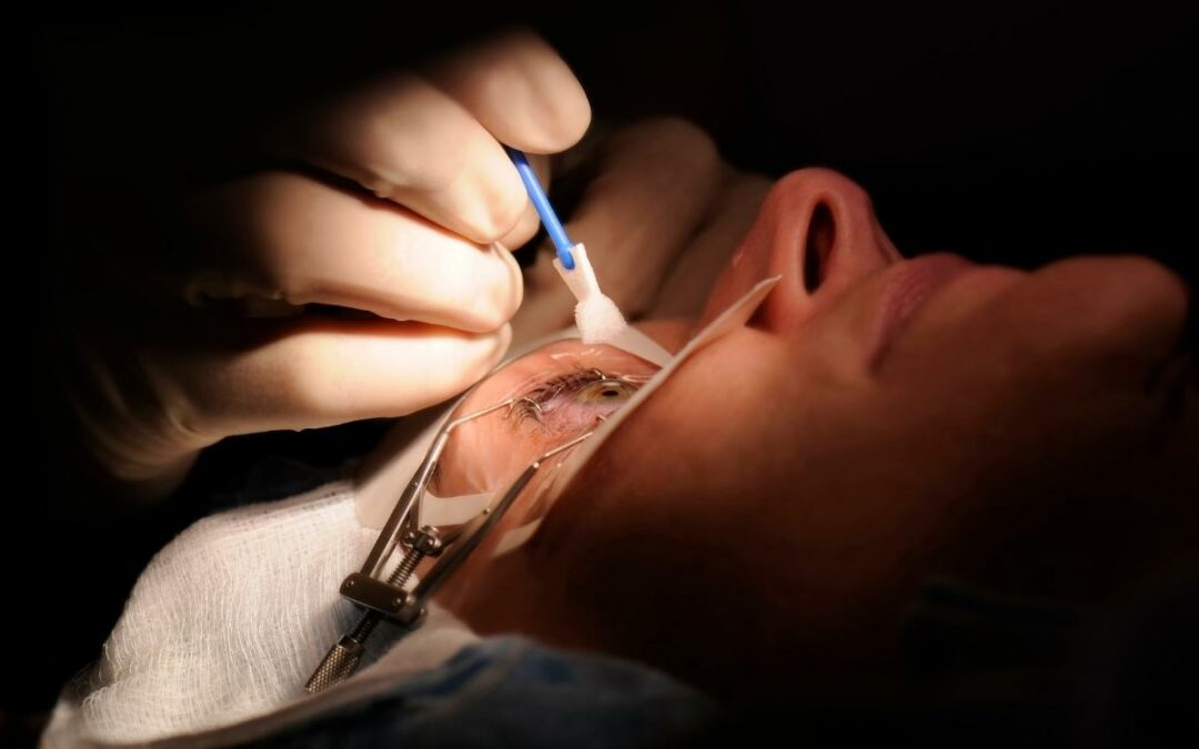 What is Refractive Surgery?